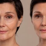 Vergleichsdarstellung eines Gesichts als Symbolbild für ein Faden Lifting ohne Operation